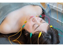 あかり鍼灸接骨院/電気を流す美容鍼