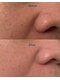 クラウドナインエステティック(Cloud Nine esthetic)の写真/SNSで話題の第5世代ピーリング【ダクトピール】導入！酸も水も使わず美容成分100％のピーリングで肌育再生