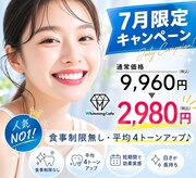 歯のホワイトニング 岐阜アクティブG店