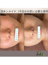 リラクゼーションサロン ラキ(laki)/トロイアルケ、スキンメイド