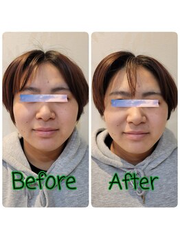 ピエール ナリタイラボ(Piel NARITAI LABO)/小顔整体