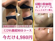 アリュールビューティー 下高井戸店(ALLURE BEAUTY)の雰囲気（夏に向けた痩身コース多数掲載★エイジングケアや美肌ケアも◎）