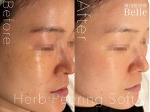 ベル 渋谷(belle)/ハーブピーリング｜店内内装