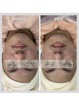 じゅえる/→続き メンズエステも大好評