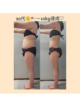 ルミルナ(Lumi Luna)/20代★－10kg！！