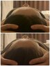 【頭蓋調整で骨格から小顔に♪】脳セラピー×小顔マシン×小顔筋膜 ¥9800