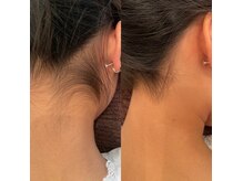 ネイルアンドアイラッシュ レーヌ(Reine)の雰囲気（脱毛やWax脱毛などいろんなメニューがございます♪）