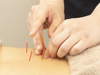 ニワトコ 与野駅前院(niwatoco)/鍼施術