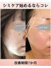 【年末までのお得なクーポン】肌代謝をあげて肌悩みにアプローチ通常¥16,500