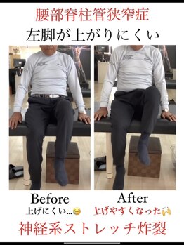 ストレッチ専門スタジオ スリーエス 北見スタジオ(SSS)/様々な症状も解消できます。