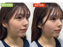 ヘッドミント 本町店/小顔コルギ×ドライヘッドスパ