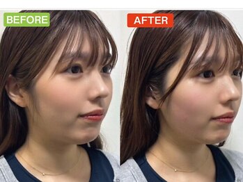 ヘッドミント 本町店/小顔コルギ×ドライヘッドスパ