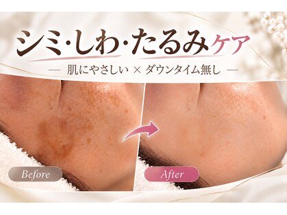 ミライ(Mirai)の写真