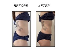 ファミーユ 新宿店/【インディバ　お腹ケア】