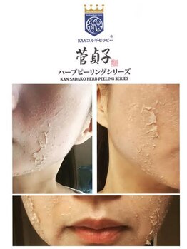 ファンシアジーク(Fanciasieg.)/菅貞子ハーブピーリング