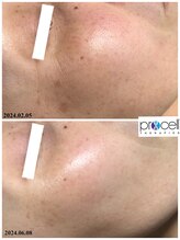 ヒルナム(Heal Nam)/プロセルセラピーズ~フェイス~