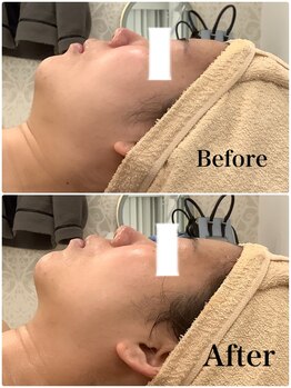 スペチアーレ 夙川/驚きの引き上がり