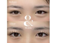 似合わせデザインお任せください！