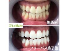 ルブラン 奈良店(Le Blanc)/好感度UP！！