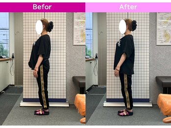 八女整体院/~姿勢改善~猫背・巻肩・反り腰