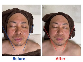 ココリラ/睡眠｜ヘッドマッサージ｜リンパ