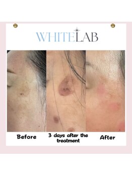 ヴィーナス 船橋駅前店(VENUS)/ホワイトラボ