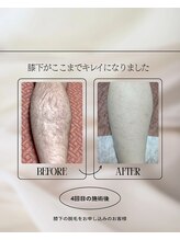 シルクスタンダード(SILK STANDARD)/お客様ビフォーアフター