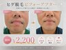 【朝の時短に】◇清潔感UP◇ヒゲ脱毛 初回 ¥2200