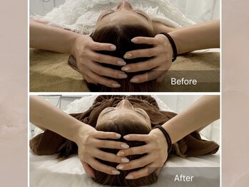 ステラルーテ(Stella lute)/脳洗浄 1回