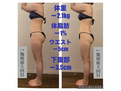 ソーノ(sono)の写真