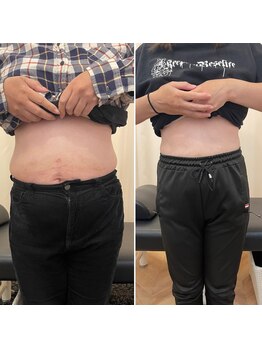 ナオ接骨院(NAO接骨院)/Before/After