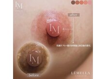 ルナベル(Luna Bell)の雰囲気(1度の施術で半永久的★メラニンケアNo.1LEMELLA(ルメラ)導入店)