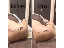フィール(feel)/整体＋リンパ　Before & After
