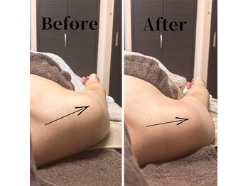 フィール(feel)/整体+リンパ Before & After