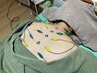 【自律神経を整えて睡眠の質を改善したい方へ】　全身はり＋お灸