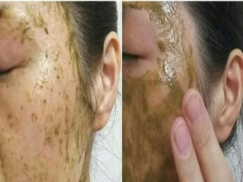 エッセンス トーキョウ(essence tokyo)/ハーブピーリング