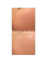 ノノサロン(nono salon)/