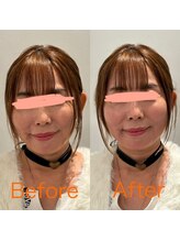 ヨサパーク フェザー(YOSA PARK Feather)/高濃度水素酸素吸入60分後