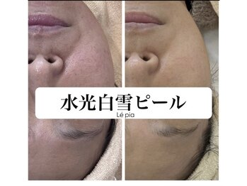 レピア(Le'pia)/水光白雪ピーリング