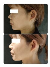 ソラ(sola*)/レモンボトル