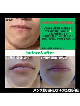 ネクストプラス 大分別府店(NEXT+)/ビフォーアフター