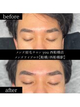 ユー 西船橋店(you)/ビフォーアフター写真