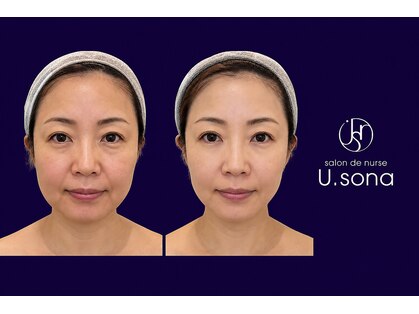 サロン ド ナース ユー ソナ(salon de nurse U.sona)の写真