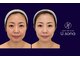 サロン ド ナース ユー ソナ(salon de nurse U.sona)の写真