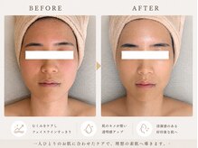 ソワンドゥー(Soin doux)の雰囲気（落ち着く癒やし空間で自分磨き♪むくみをケアしてすっきり小顔）