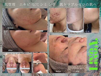 リノアドット(LiNOA.)の写真