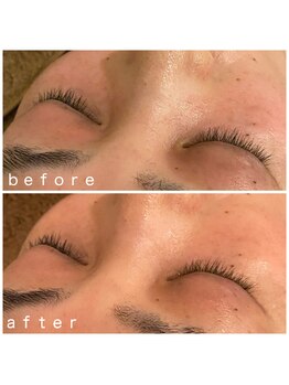 メナードフェイシャルサロン 岐阜茜部/コラックスケアパック