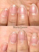 マリーロール 梅田店(Marie Laure)/自爪育成/深爪矯正/ネイルケア