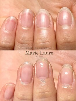 マリーロール 梅田店(Marie Laure)/自爪育成/深爪矯正/ネイルケア