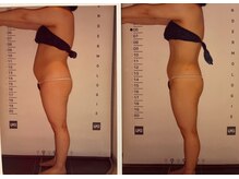 ビューティースパ/ポッコリお腹スッキリ凹む